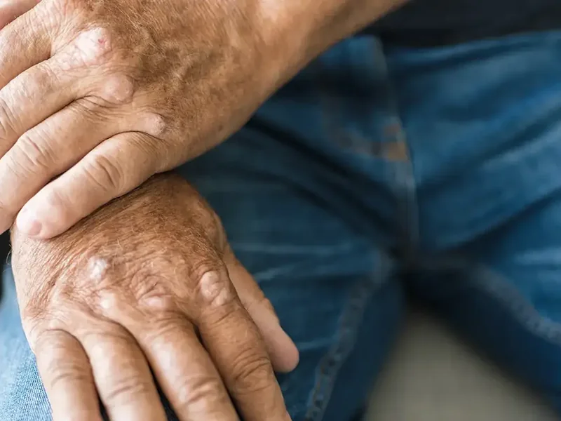 Shoulder pain treatment
