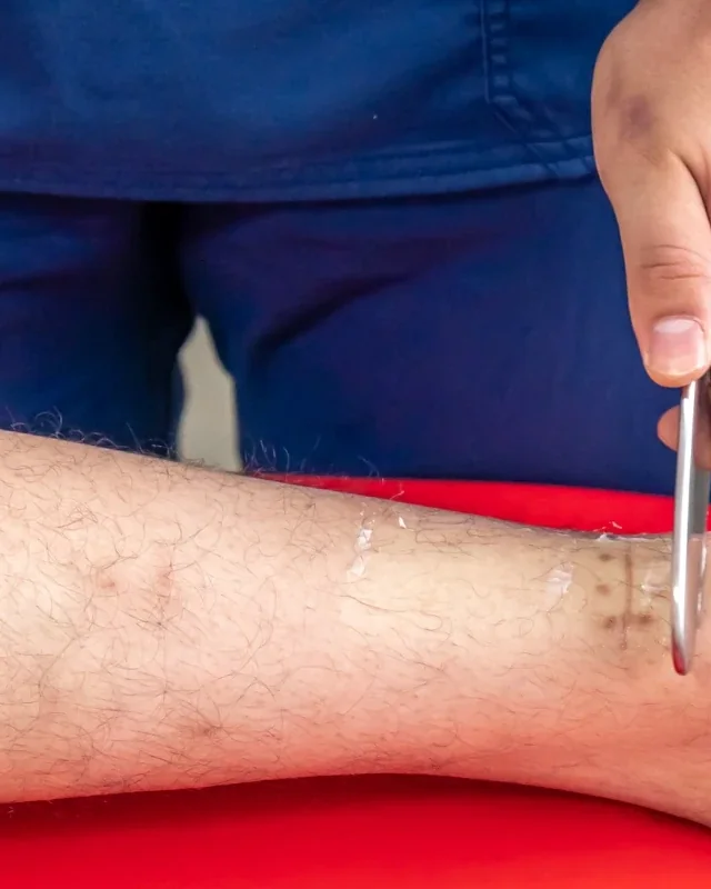 Therapist using a soft tissue instrument on a patient's calf